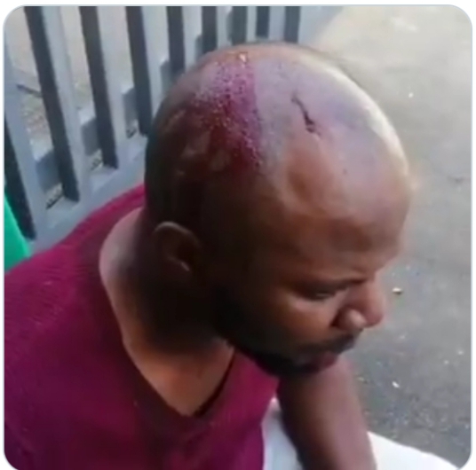 Police Brutality on Arise News Cameraman